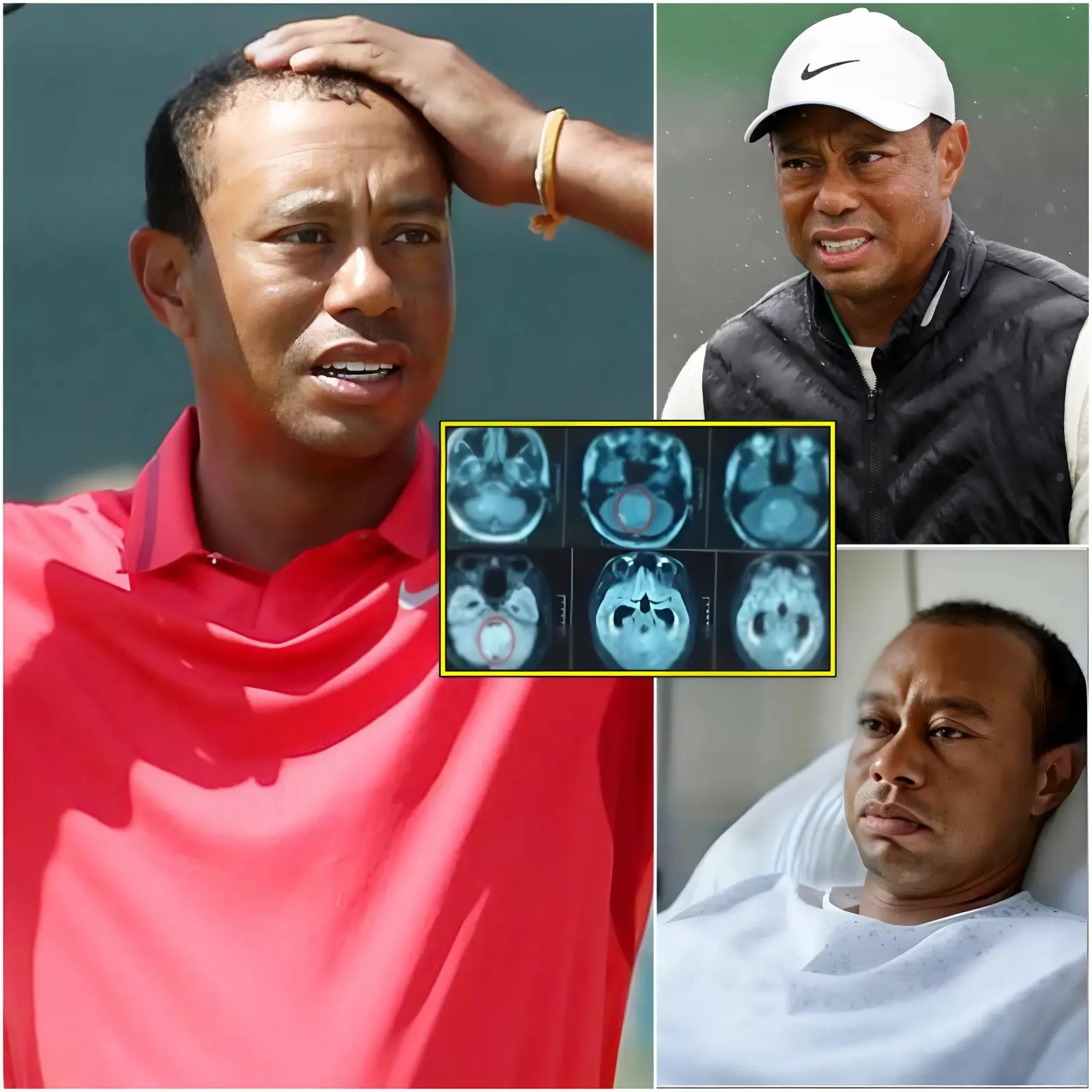 Cover Image for 🚨💔 HEARTBREAKING NEWS: Just 30 minutes ago in California, USA. At the age of 49, the family of golf legend Tiger Woods has issued an urgent and emotional announcement to his followers that he is currently…👇