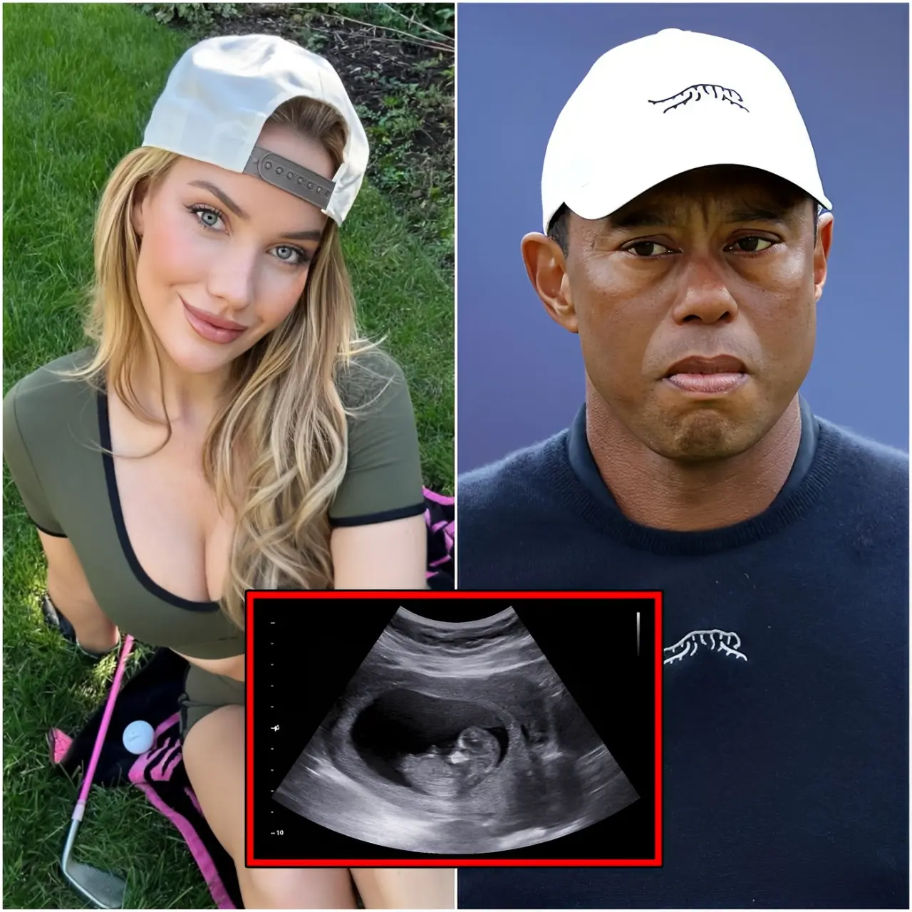 Cover Image for GOLF WORLD SHOCKED🔴 In the wake of the Tiger Woods scandal, Paige Spiranac has come forward to announce she is pregnant. However, DNA test results have revealed a bombshell — the baby is …👇👇