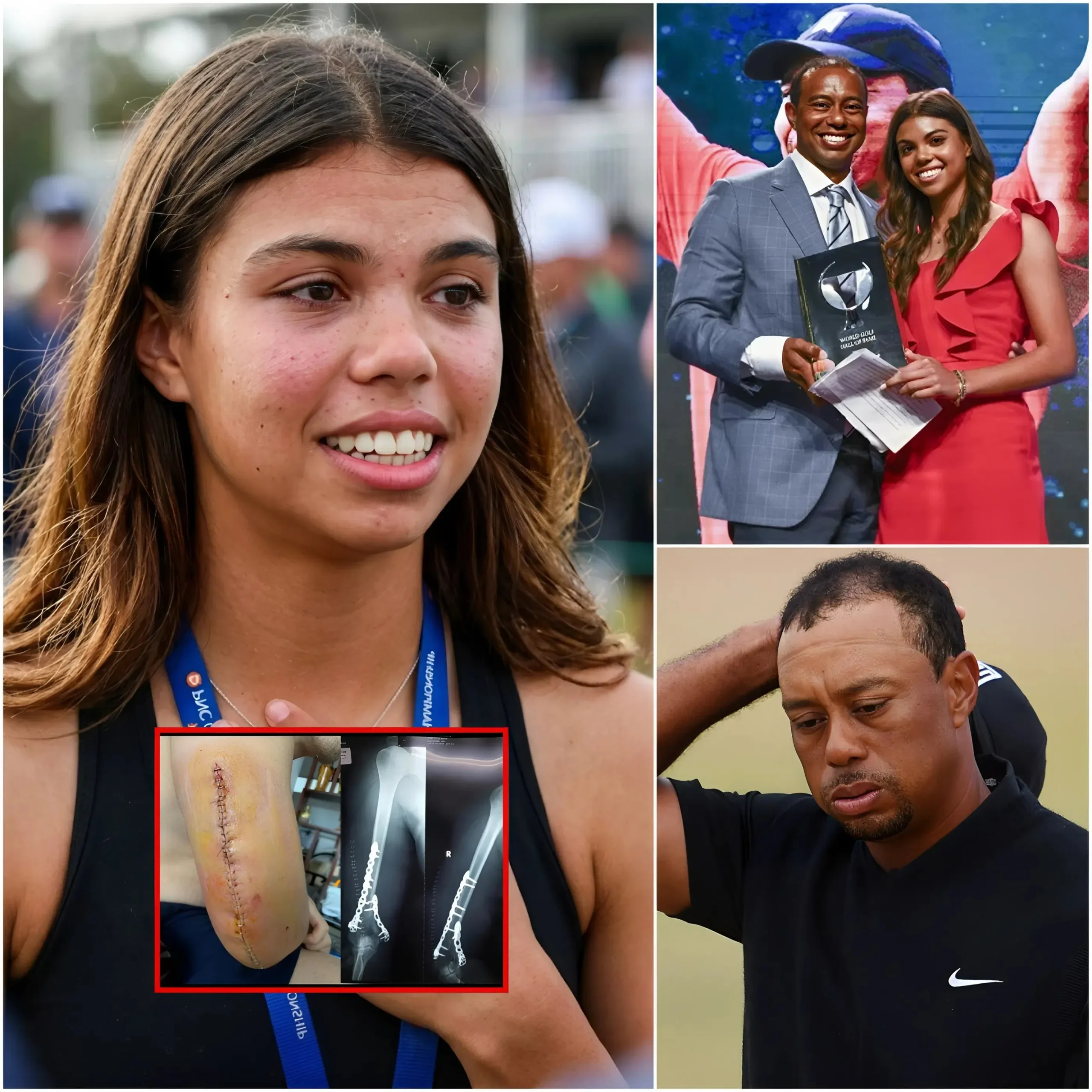 Cover Image for 🔥 BREAKING: Sam Alexis Woods reveals Tiger Woods is experiencing complications after surgery and is being treated in the ICU. She emotionally appealed to fans to pray for and send strength to her father to help him get through this difficult time.