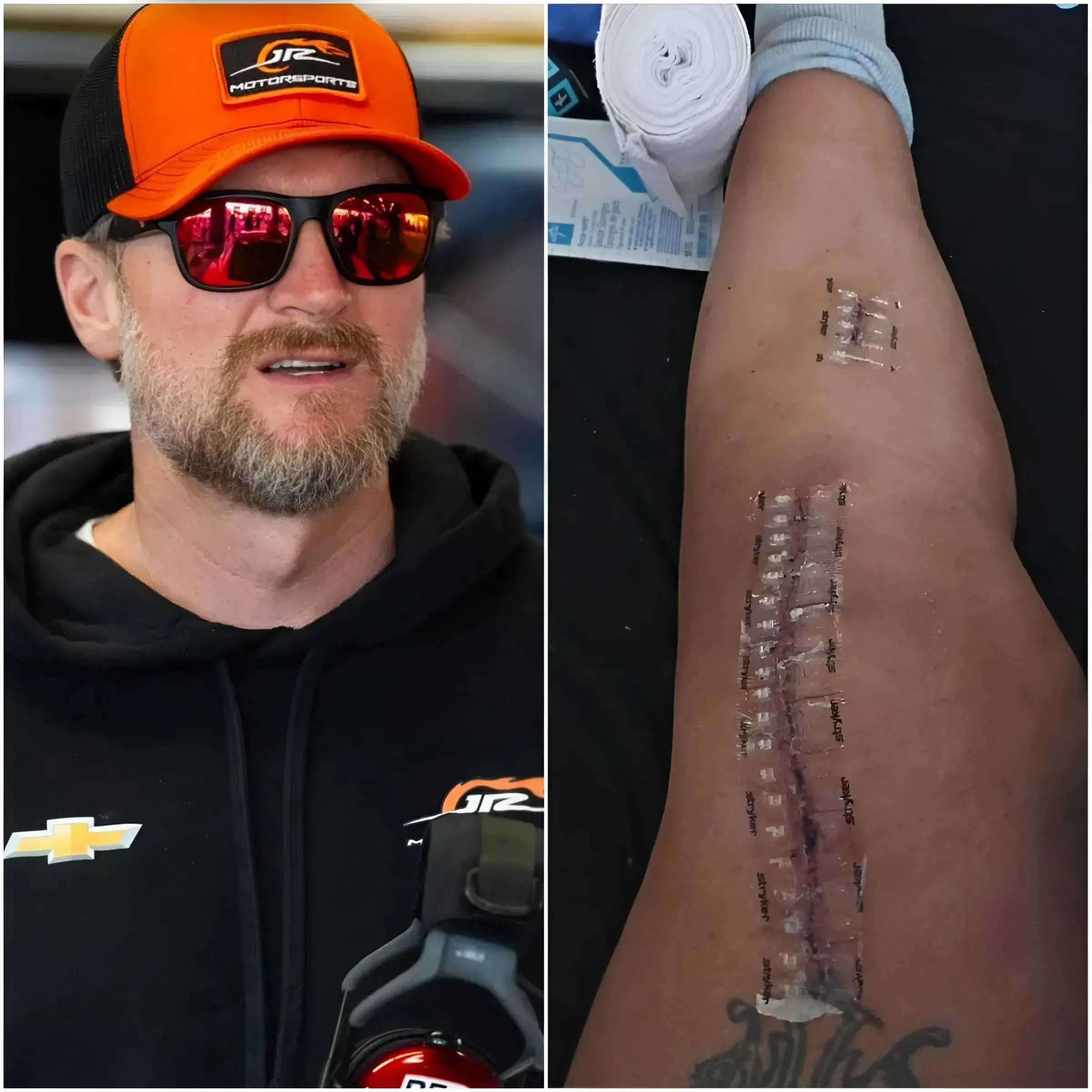 Cover Image for 💝 BREAKING UPDATE: Dale Earnhardt Jr. shares heartfelt message after surgery After a period of silence, NASCAR legend has spoken about his recovery journey. He confirms the surgery is complete and while the road ahead remains long, his spirit stays strong.