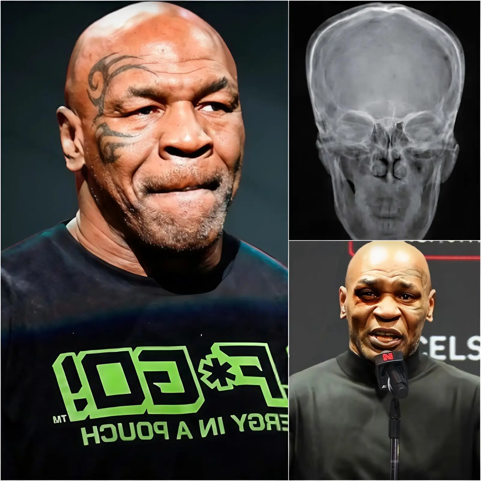 Cover Image for BREAKING NEWS: Mike Tyson has announced that he is unable to participate in the match against Floyd Mayweather and that the fight will never take place. After hearing the full reasoning, Mike’s fans are deeply heartbroken and worried for his health.