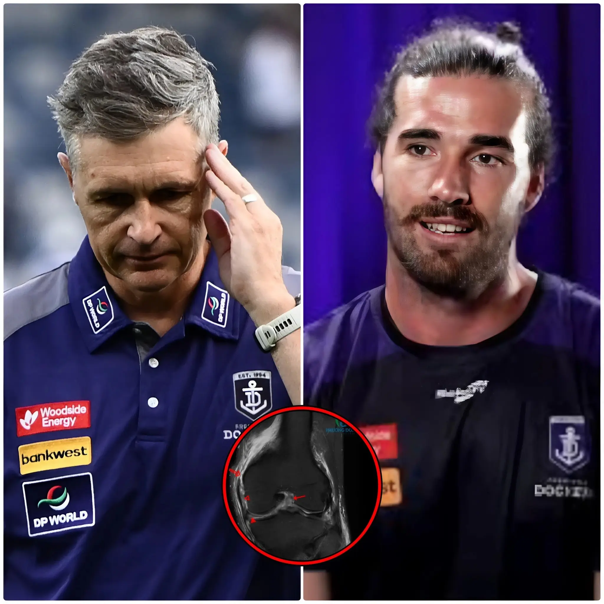 Cover Image for JUST IN🔥Head coach Justin Longmuir has just updated on the health and MCL scan results of Fremantle Dockers captain Alex Pearce, and there will be some changes for the game against St Kilda, causing concern among Fremantle fans…